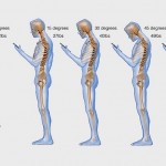 Constant-texting-is-hurting-your-spine-badly