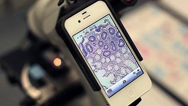 turn-a-smartphone-into-a-virus-detecting-microscope.jpg
